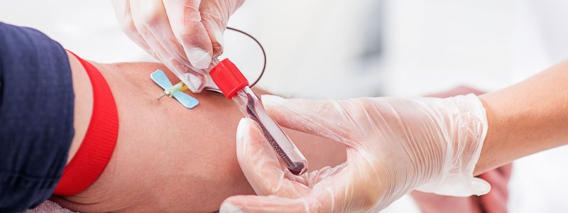 Can You Test For Depression With A Blood Test