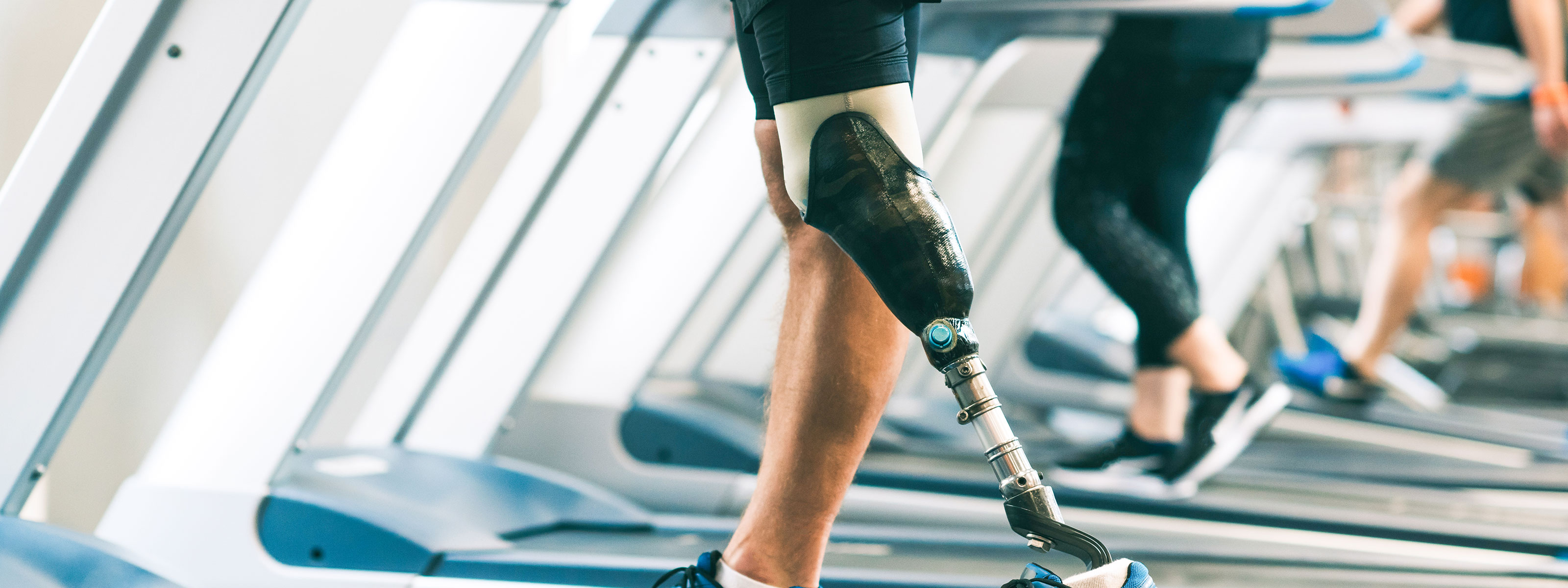 New Amputation Surgery Technique May Lead To Better Control Of Prosthetics