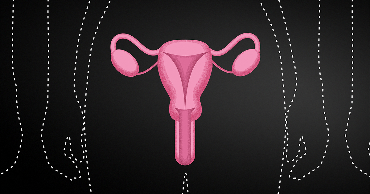 Uterus Transplants A Step Closer To Overcoming Infertility 