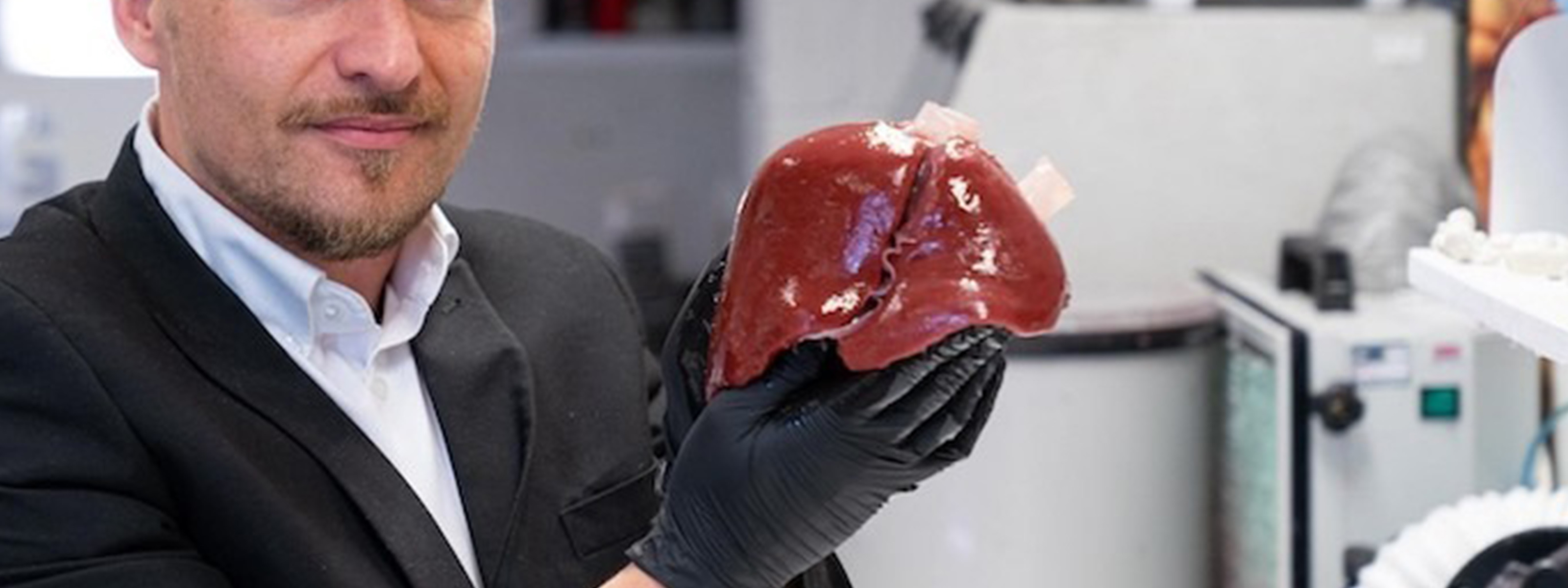 Surgeons can now practice on a 3D-printed copy of your liver