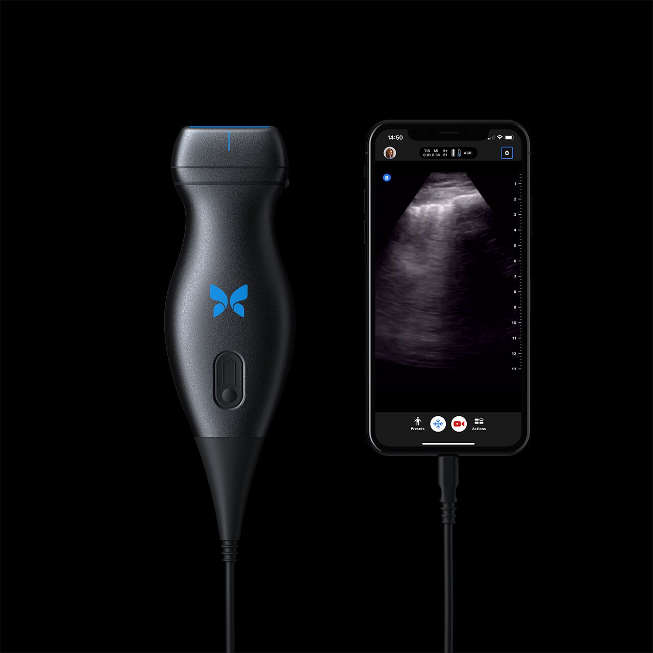 This Portable Ultrasound Machine Helps Catch COVID-19