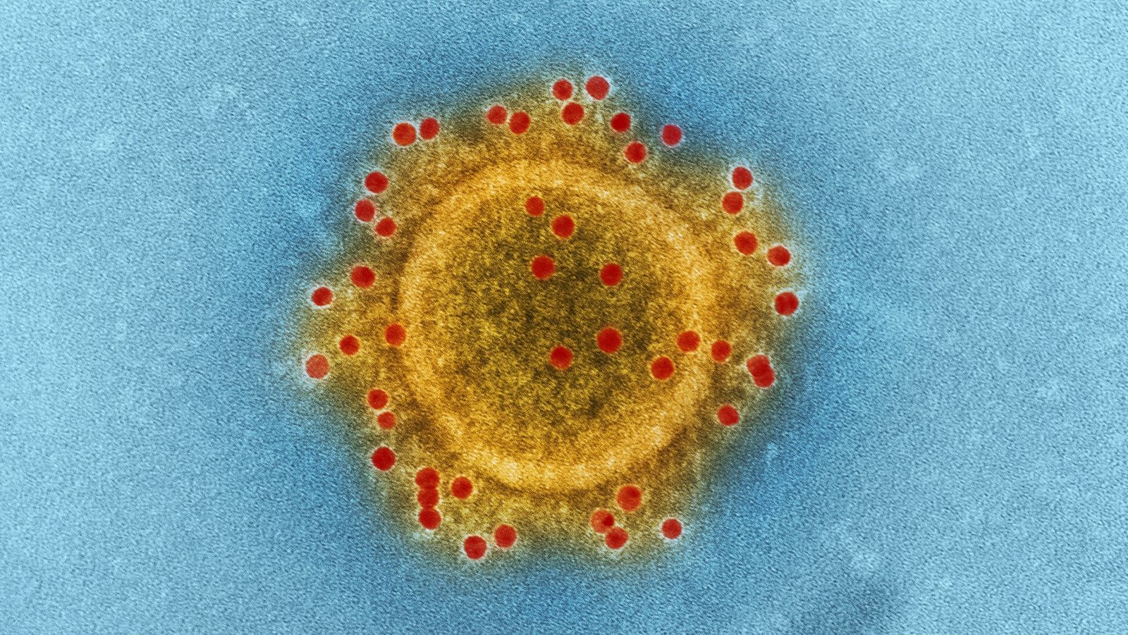 Researchers identified over 5,500 new viruses in the ocean