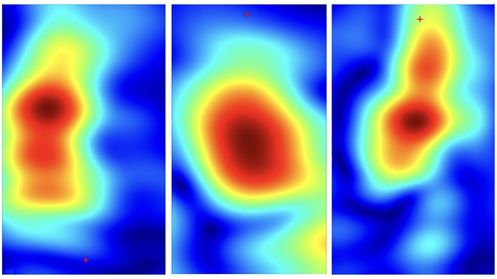 5g-millimeter-wave-tech-may-prevent-unnecessary-skin-biopsies