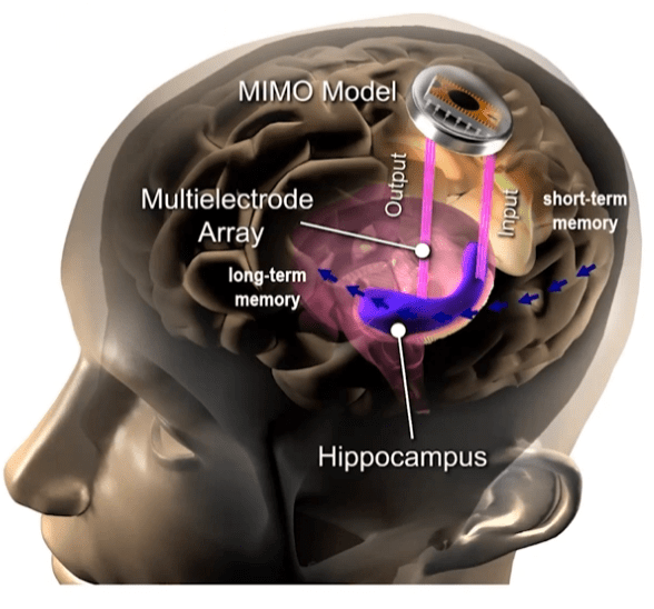 Brain-zapping tech improves memory by more than 50%