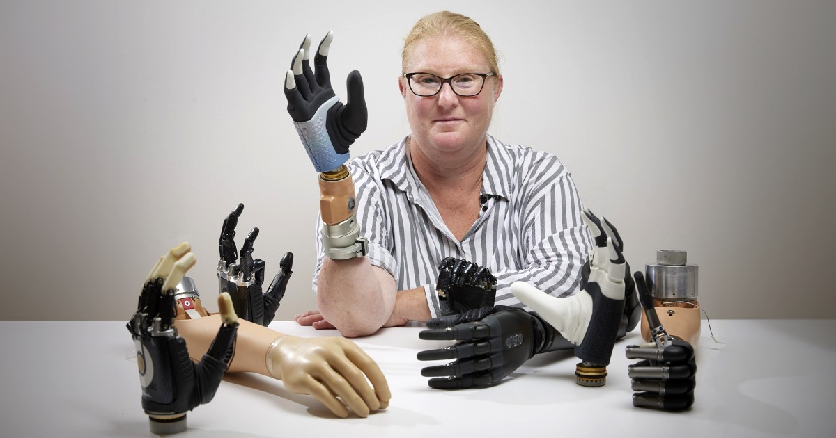 Getting a Grip on the Bionic Arms Market