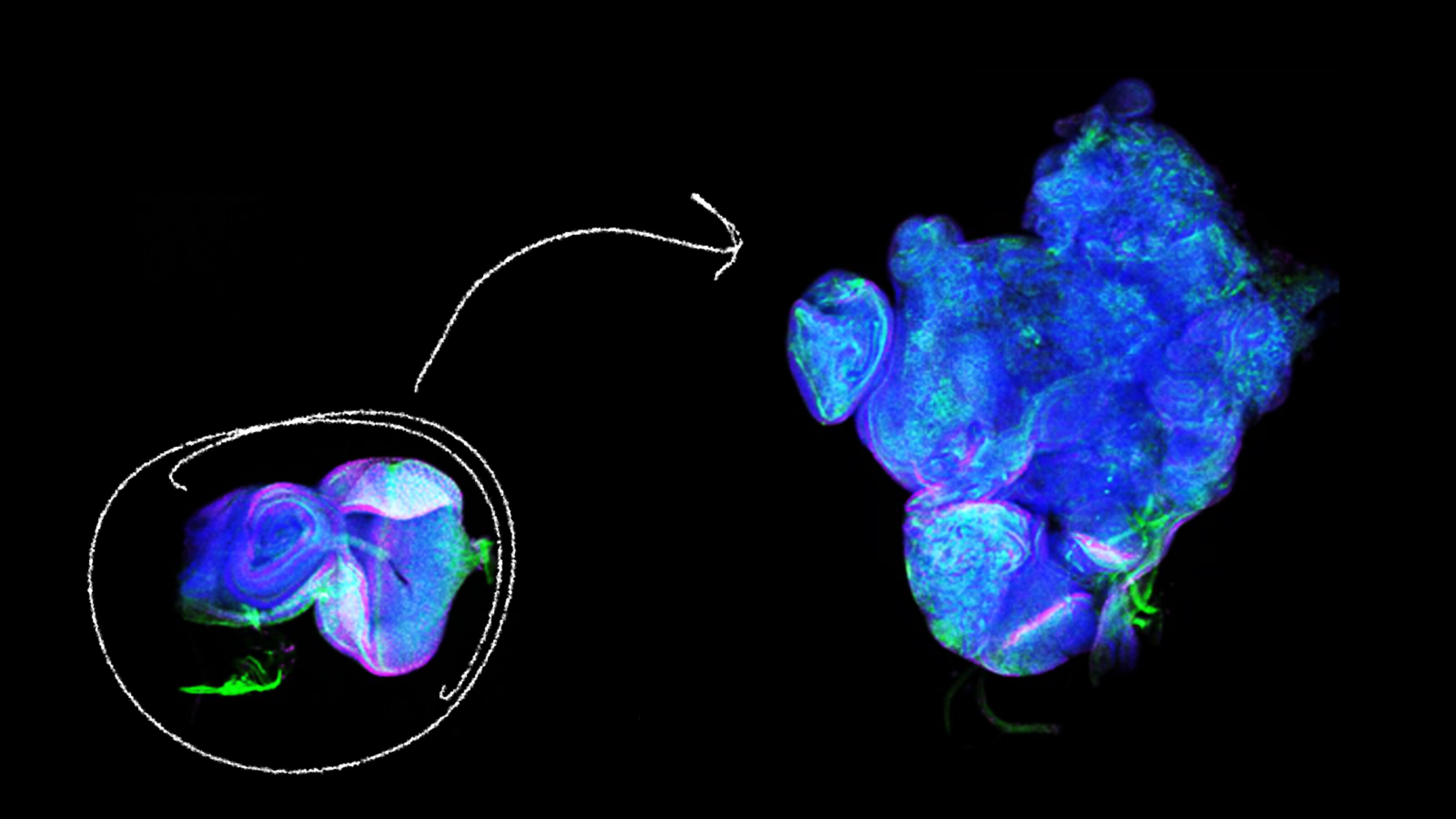 New study challenges long-held assumption about cancer