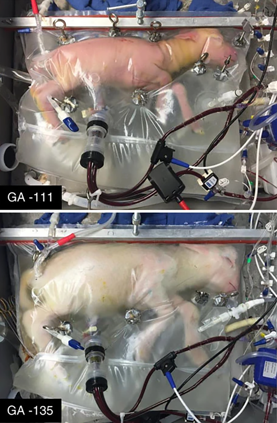 Two lambs inside artificial wombs filled with fluid, connected to tubes and medical equipment. The top lamb is labeled "GA-111" and the bottom lamb is labeled "GA-135".